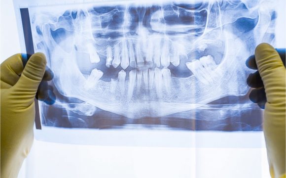 Radiologia e Diagnostica
